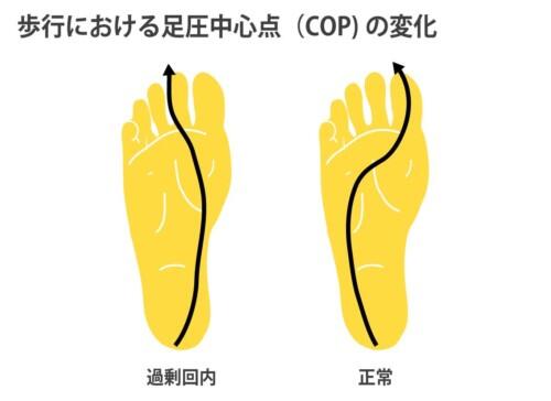 歩行における足圧中心点の変化